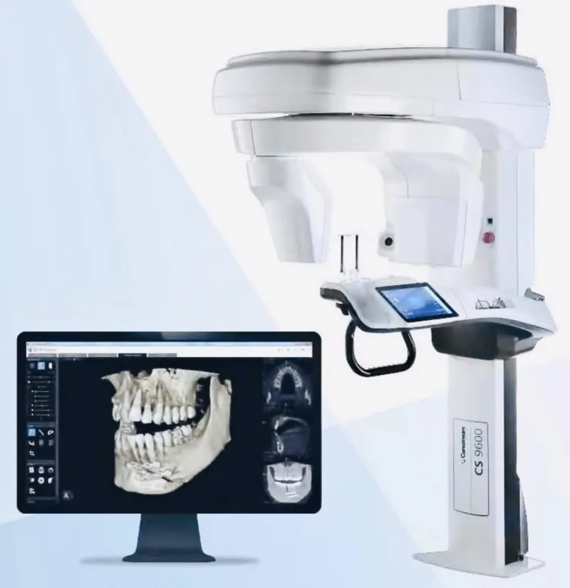 CBCT 3D scanner and imaging display